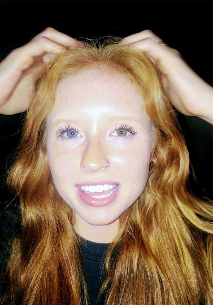 ginger with heterochromia