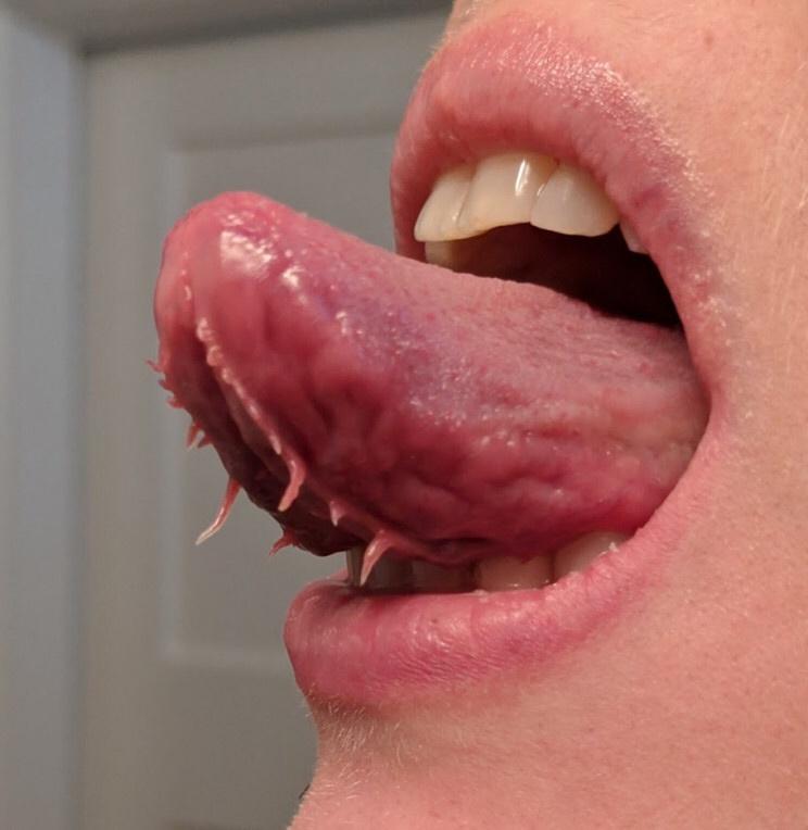 rare tongue