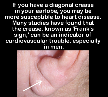 27 facts about the heart - 'If you have a diagonal crease in your earlobe, you may be more susceptible to heart disease. Many studies have found that the crease, known as 'Frank's sign,' can be an indicator of cardiovascular trouble, especially in men. an