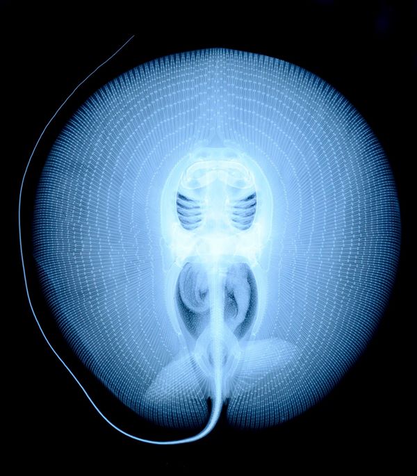 Xray of a sting ray