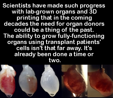 photo caption - Scientists have made such progress with labgrown organs and 3D printing that in the coming decades the need for organ donors could be a thing of the past, The ability to grow fullyfunctioning organs using transplant patients' cells isn't t