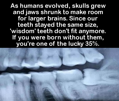 jaw - As humans evolved, skulls grew and jaws shrunk to make room for larger brains. Since our teeth stayed the same size, "wisdom' teeth don't fit anymore. If you were born without them, you're one of the lucky 35%.