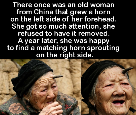 photo caption - There once was an old woman from China that grew a horn on the left side of her forehead. She got so much attention, she refused to have it removed. A year later, she was happy to find a matching horn sprouting on the right side.