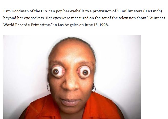 funny pictures of people - Kim Goodman of the U.S. can pop her eyeballs to a protrusion of 11 millimeters 0.43 inch beyond her eye sockets. Her eyes were measured on the set of the television show "Guinness World Records Primetime," in Los Angeles on .