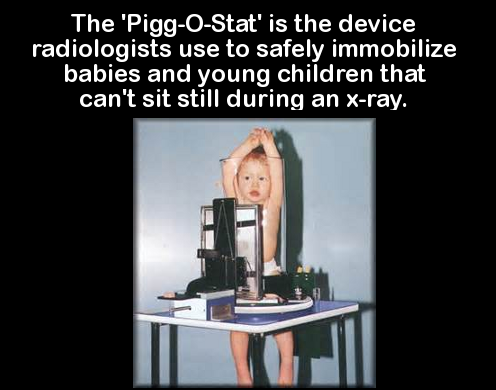 small children xray - The 'PiggOStat' is the device radiologists use to safely immobilize babies and young children that can't sit still during an xray.