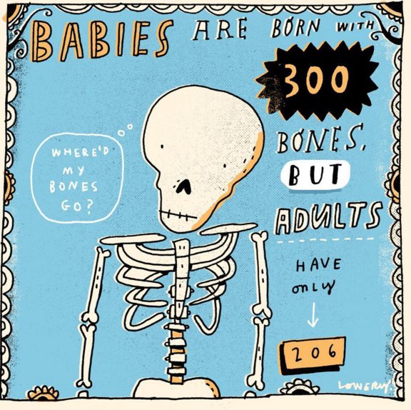 cartoon - Babies Are Born With 300 Where'D Bones Go? Bones, But Adults Unds Have only 206 Lowery