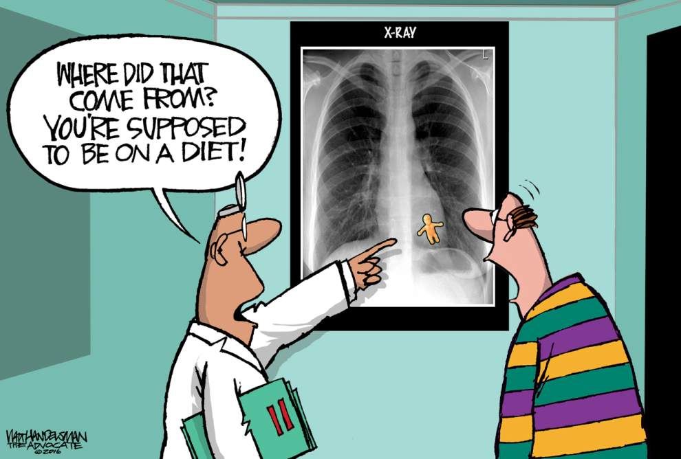 mardi gras funny - XRay Where Did That Come Prom? You'Re Supposed To Be On A Diet! & Marijandensman The Avocate Zdi