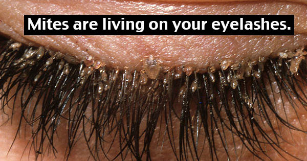 Mites are living on your eyelashes.