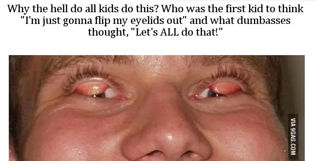 eyelash - Why the hell do all kids do this? Who was the first kid to think "I'm just gonna flip my eyelids out" and what dumbasses thought, "Let's All do that!" Via 9GAG.Com