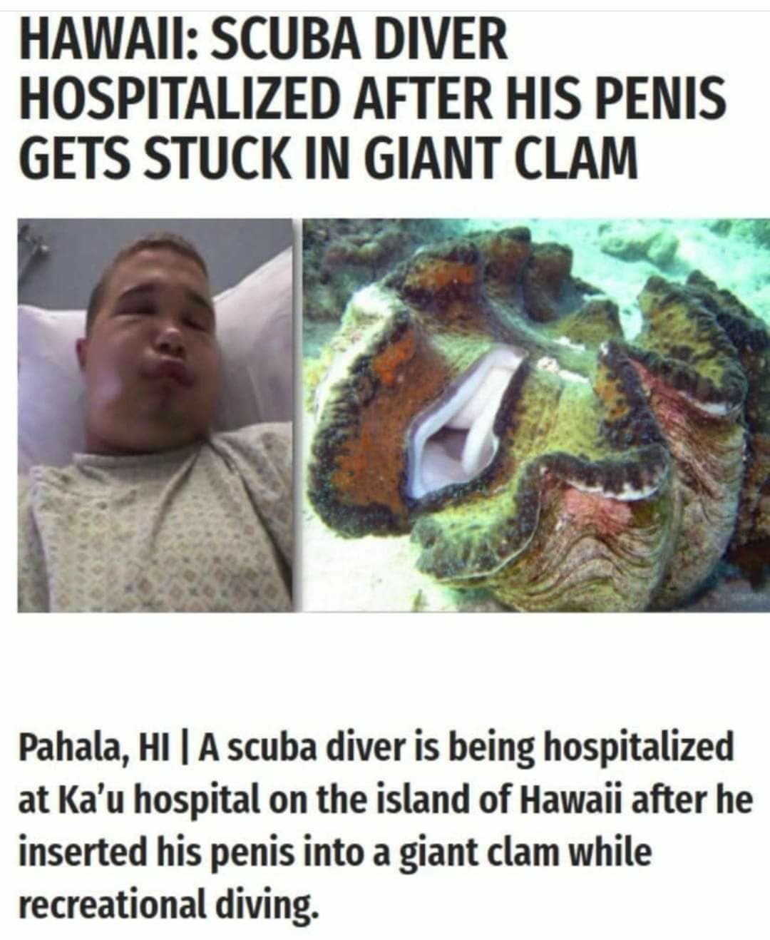 Memes and Fails - hawaii scuba diver hospitalized after his penis gets stuck in giant clam - Hawaii Scuba Diver Hospitalized After His Penis Gets Stuck In Giant Clam Pahala, Hi A scuba diver is being hospitalized at Ka'u hospital on the island of Hawaii a