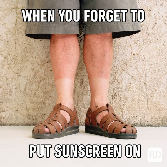 hot memes for summer - Sandal - When You Forget To Put Sunscreen On Rd