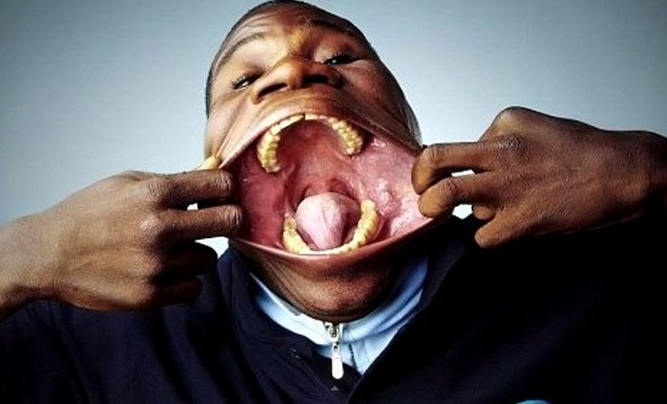 This guy holds the record for being able to spread his mouth open the biggest (his dentist loves him)