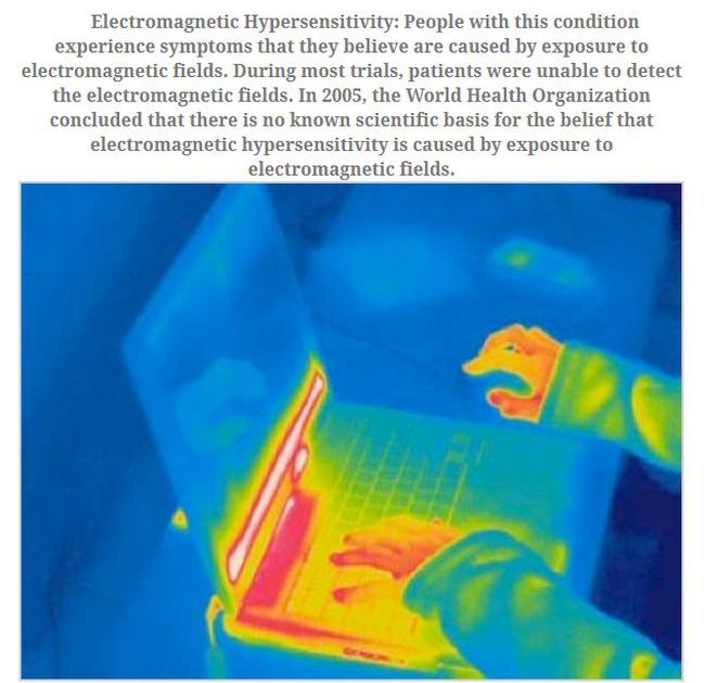 water - Electromagnetic Hypersensitivity People with this condition experience symptoms that they believe are caused by exposure to electromagnetic fields. During most trials, patients were unable to detect the electromagnetic fields. In 2005, the World H
