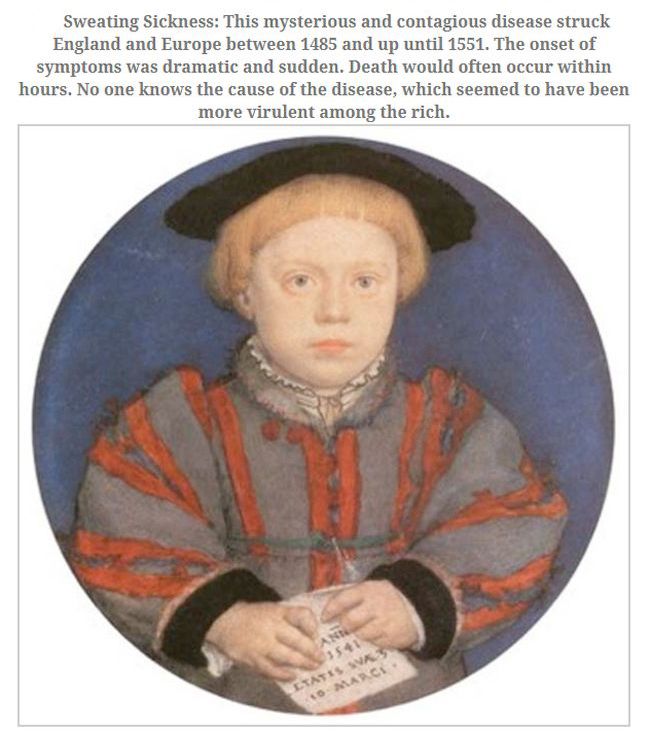 charles brandon duke of suffolk - Sweating Sickness This mysterious and contagious disease struck England and Europe between 1485 and up until 1551. The onset of symptoms was dramatic and sudden. Death would often occur within hours. No one knows the caus