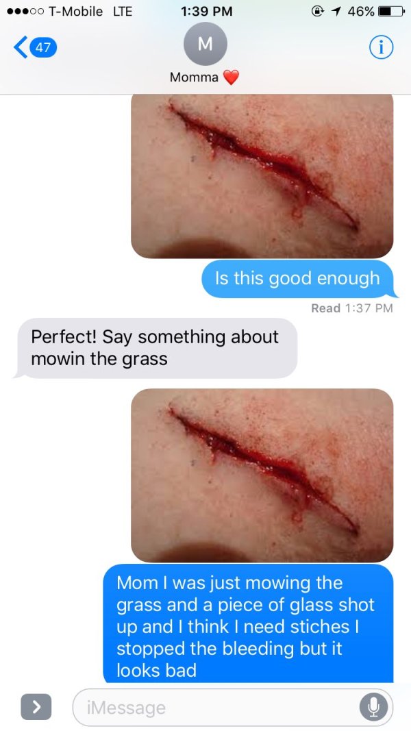 Daughter sends photo of a cut, makes up lawnmower story