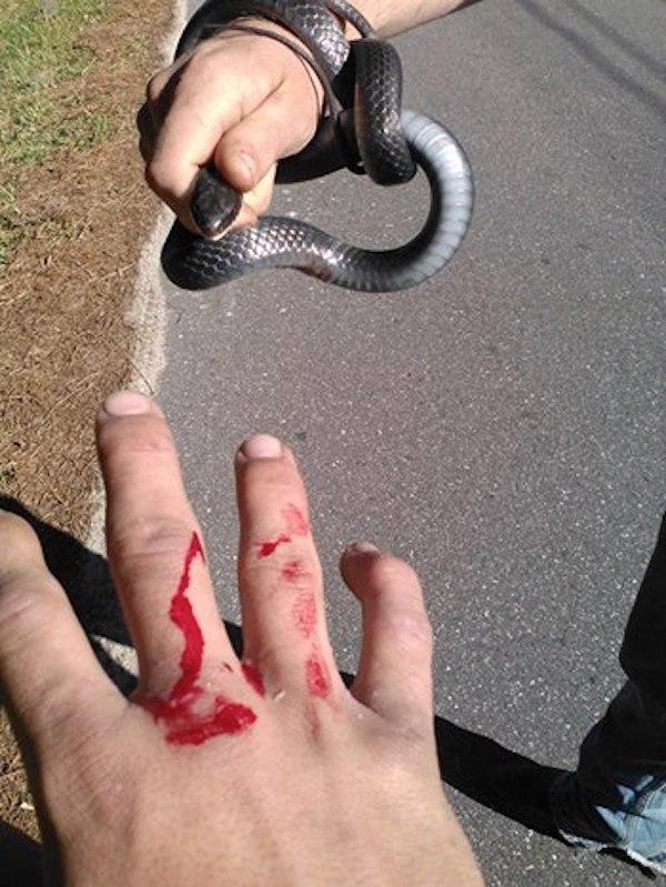 #3 First Time   It's no the first time that Hartfield has been bitten by his snake. His Facebook page shows photos of bites with captions such as, "Bastard bit me."