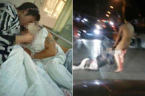 A jealous wife in China chopped off her cheating husband’s p*nis as he slept, then snuck into his hospital room after he had it sewn back on — and hacked it off again and tossed it out the window. goo.gl/faaw7y