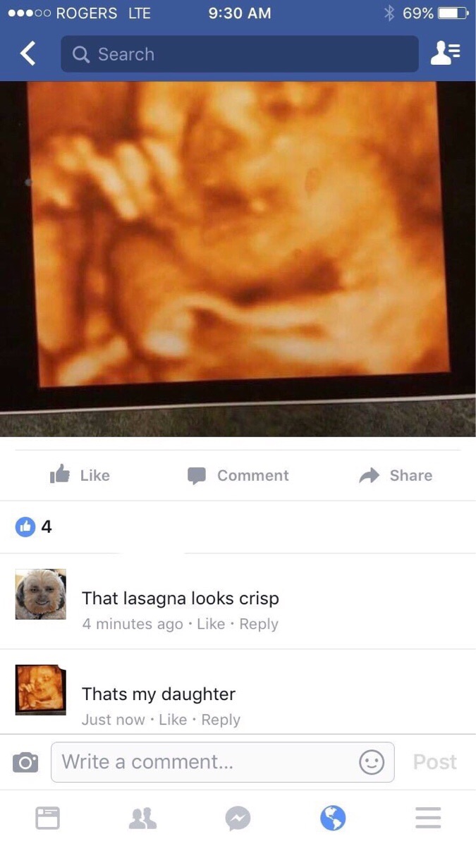 Someone comments on an ultrasound pic that it looks like some crispy lasagna