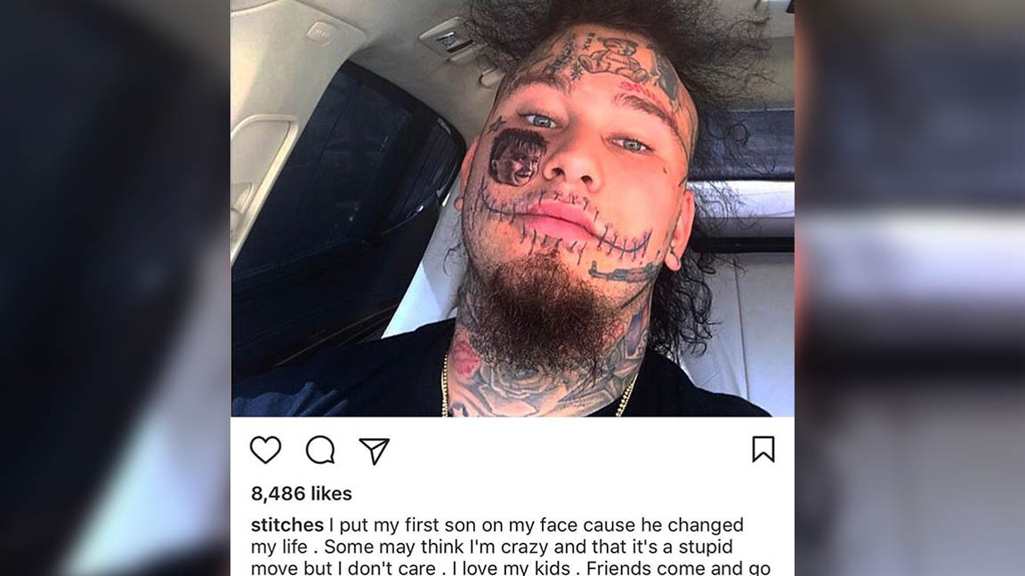 Not only did Stitches, tattoo stitches across his face but he also got a portrait of his firstborn child on his cheek. The Florida rapper is known for his hit song, "Brick In Yo Face" as well as his crazy tattoos. 