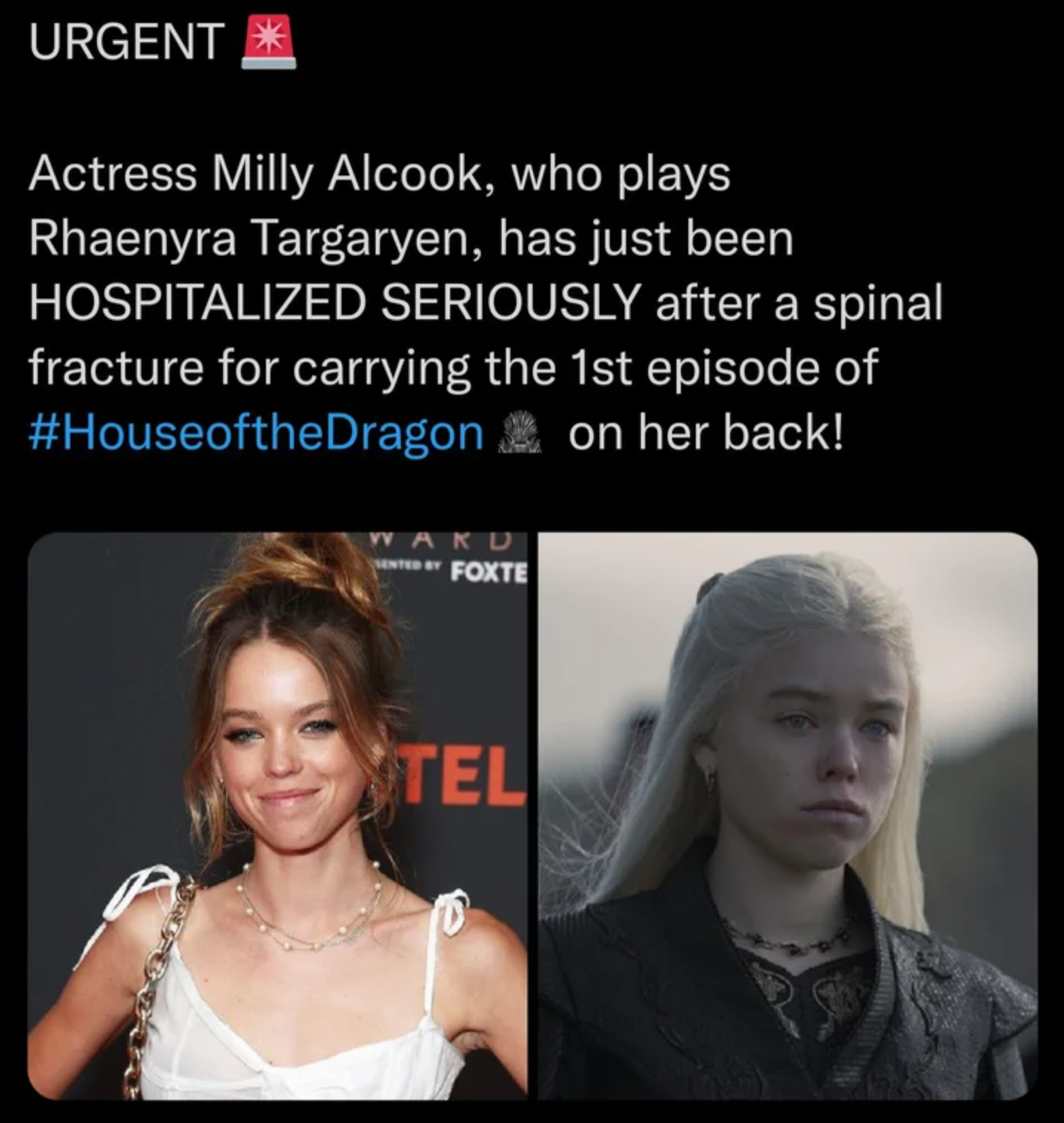 photo caption - Urgent Actress Milly Alcook, who plays Rhaenyra Targaryen, has just been Hospitalized Seriously after a spinal fracture for carrying the 1st episode of Dragon on her back! Aku Foxte Tel