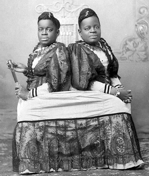 Millie-Christine - In 1851 these two ladies were born into slavery in North Carolina. Their life can only be described as too crazy to be true. They were sold for $1000 to Joseph Pearson Smith, a showman, and performed in his show until they were kidnapped. They were finally found performing in Birmingham, England were slavery was illegal. When brought back to the states they were billed as the “Two-Headed Nightengale”. They atteneded etiquette lessons, taught multiple launguages and even learn how to play music. They passed away at age 61 as the oldest known conjoined twins on record.