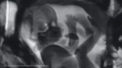 15 Animated X-ray Images That Will Ruin Your Brain