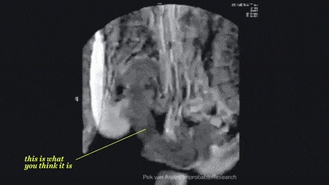 15 Animated X-ray Images That Will Ruin Your Brain