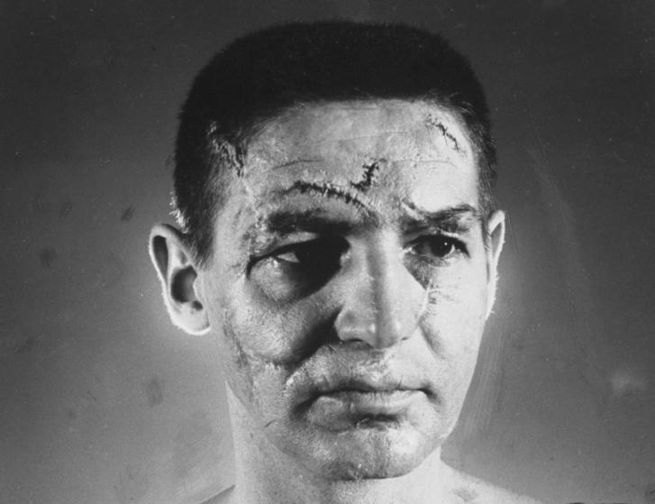 Terry Sawchuk – May 31, 1970                 Death: Physical Altercation