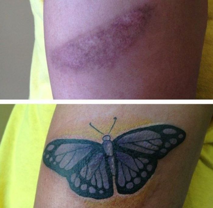 15 Tattoos That Brilliantly Cover Up Peoples Embarrassing Scars