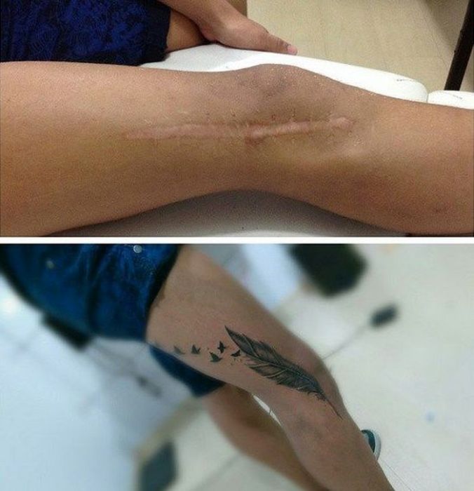 15 Tattoos That Brilliantly Cover Up Peoples Embarrassing Scars