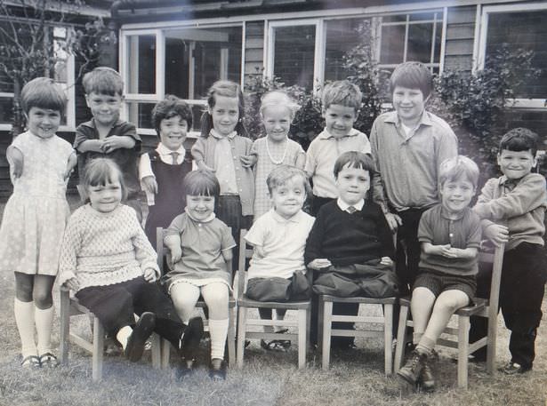 Children affected by Thalidomide in a special primary school in England in 1968. The drug was sold by a German pharmaceutical company right over the counter in the late 1950s and 1960s to cure many things, including morning sickness for pregnant women. However, that caused around 10,000 worldwide cases of phocomelia, which is when your limbs do not grow properly, which the drug itself caused. Around half of those babies survived, and ended up like these children. It took over a decade to get the drug to stop selling to pregnant women, and the scandal caused harder regulations on the effects of such drugs. Interesting note though, the drug is still in use in certain variations that treats things like cancer and leprosy.