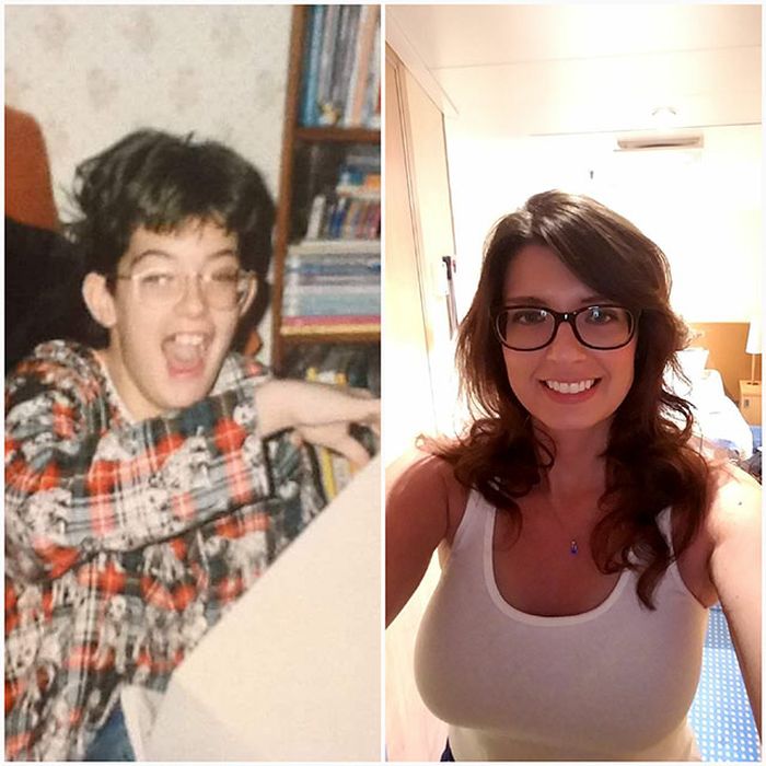 25 People That Went Through Amazing Transformations After Puberty