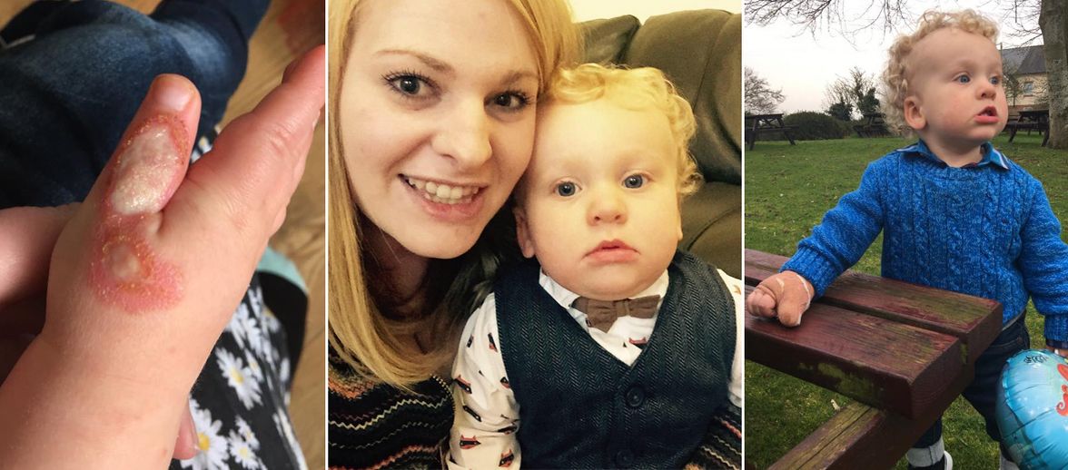 Young mum reveals dangers of hoovering with toddler after 16-month-old son suffers potentially 'life-changing injuries' includin