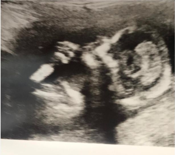 Danielle Lloyd shares first baby scan photo as she puts Jamie O'Hara drama behind her