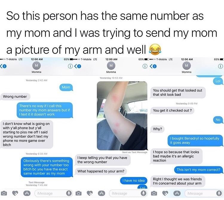 meme - web page - So this person has the same number as my mom and I was trying to send my mom a picture of my arm and well e 00 TMobile Lte 65% 0 TMobile Lte 65% 0.00 TMobile Lte 65% Ko M