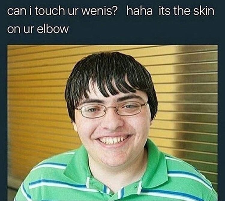 can i touch your wenis meme - can i touch ur wenis? haha its the skin on ur elbow