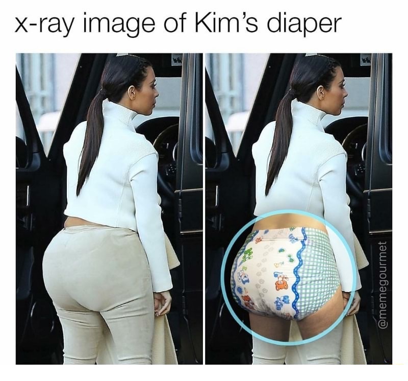 Funny meme of x-ray image of Kim Kardashian's diaper.