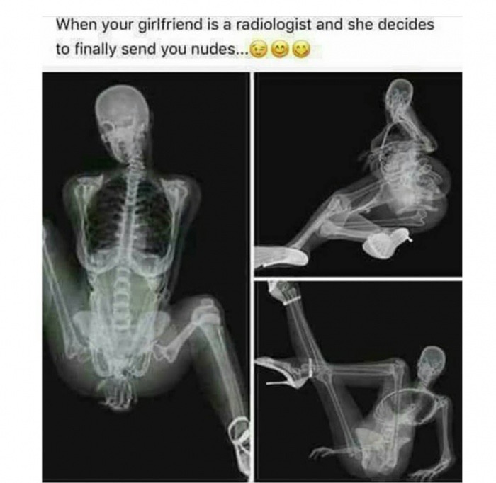 evelyn anite nudes - When your girlfriend is a radiologist and she decides to finally send you nudes...