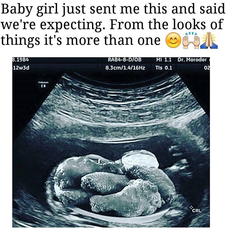 meme stream - show no love feel - Baby girl just sent me this and said we're expecting. From the looks of things it's more than one 3.1984 12w3d Raba8Diobs 8.3cm1.416Hz Mi 11 Dr. Morodor Tis 0.1 02 ch