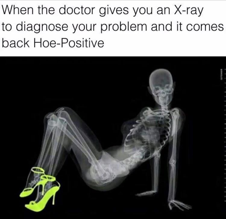 memes - miss airport 2011 calendar - When the doctor gives you an Xray to diagnose your problem and it comes back HoePositive