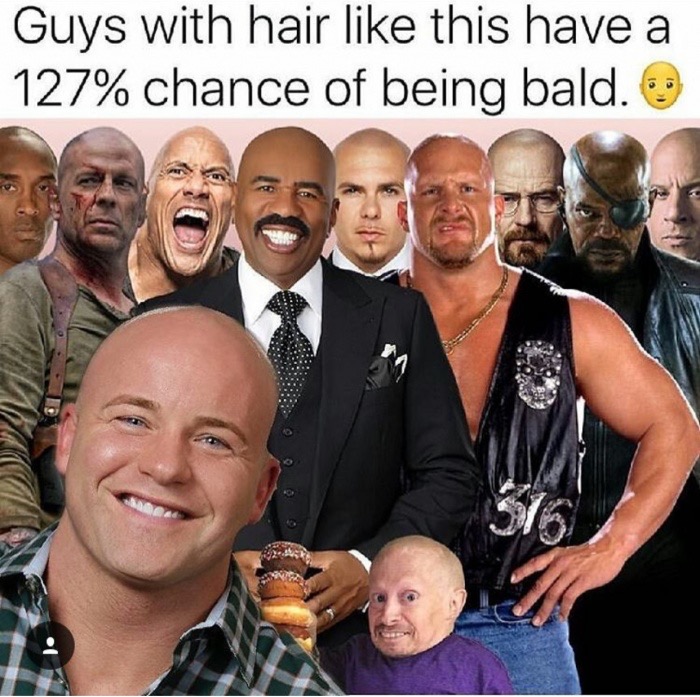 photo caption - Guys with hair this have a 127% chance of being bald. Am
