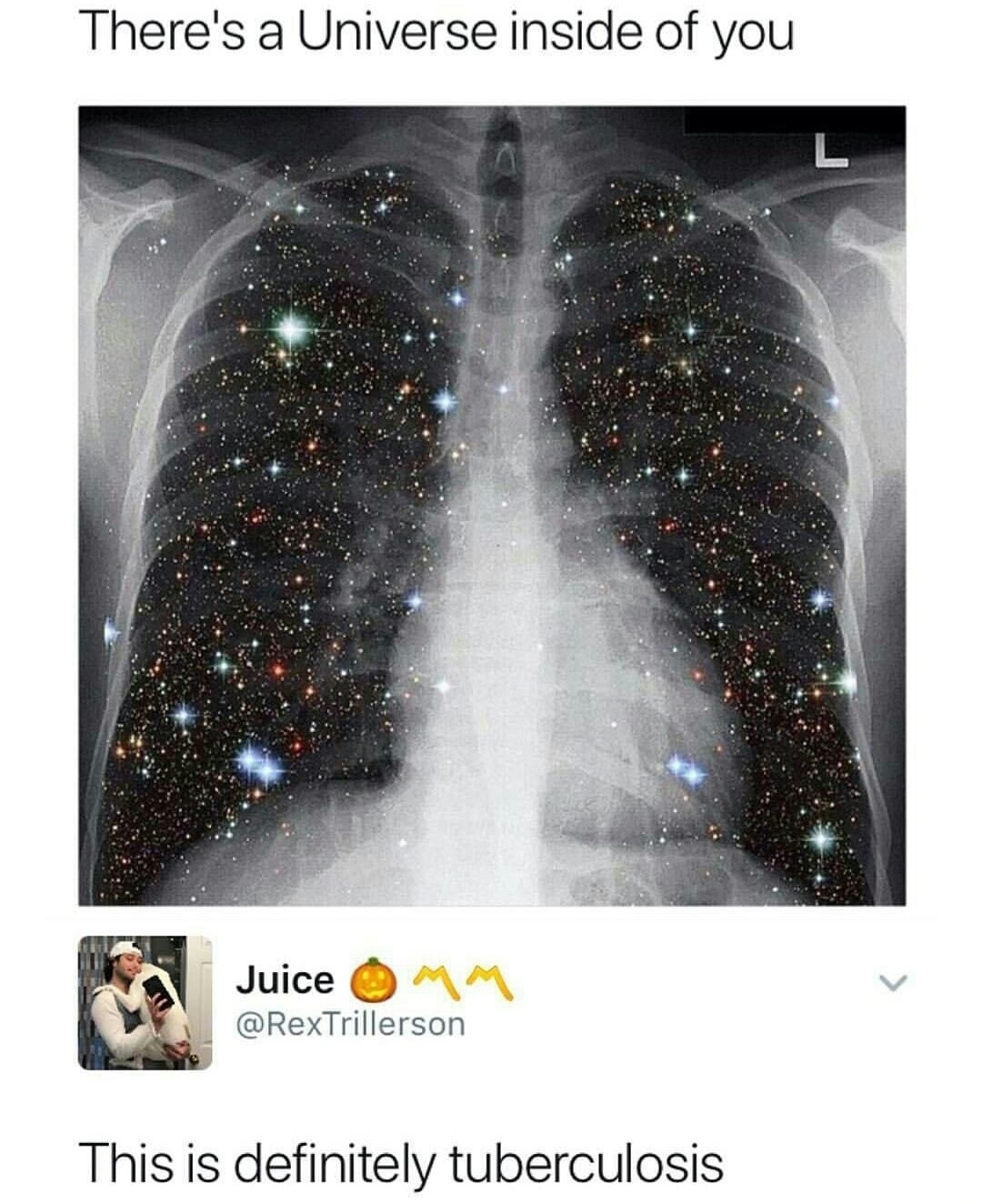 memes - there's a universe inside of you - There's a Universe inside of you Juice 0 Mm This is definitely tuberculosis