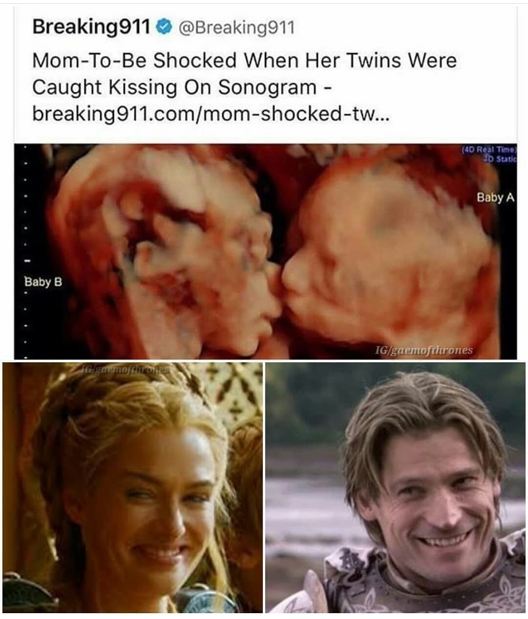 meme stream - sweet home alabama meme - Breaking 911 MomToBe Shocked When Her Twins Were Caught Kissing On Sonogram breaking911.commomshockedtw... 40 Real Timo Id Suatic Baby A Baby B Iggaemofthrones demoftTORES