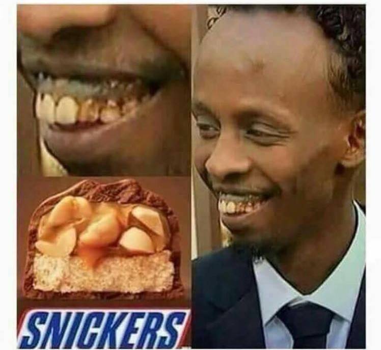 memes - snickers teeth meme - Snickers