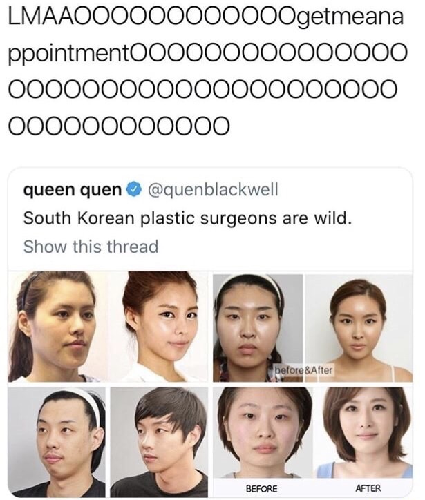 quenblackwell before and after - LMAAOO0000000000getmeana ppointmentO00000000000000 000000000000000000000 000000000000 queen quen South Korean plastic surgeons are wild. Show this thread before & After Before After