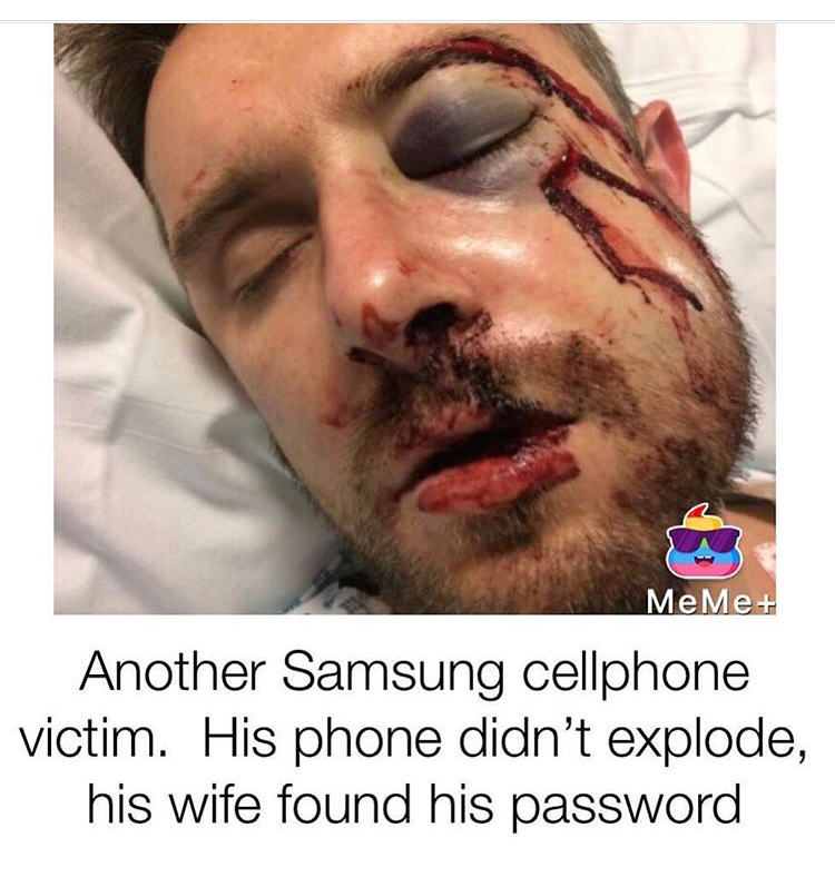 meme stream - horrendous injuries - MeMe Another Samsung cellphone victim. His phone didn't explode, his wife found his password