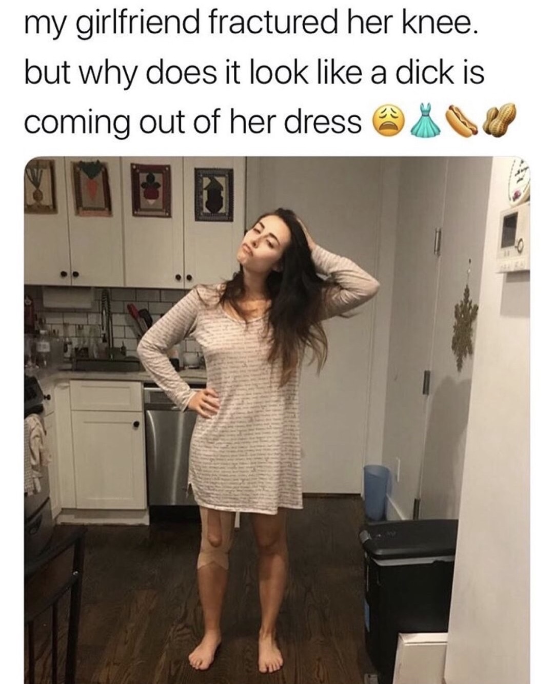 memes - giant dong - my girlfriend fractured her knee. but why does it look a dick is coming out of her dress @ U