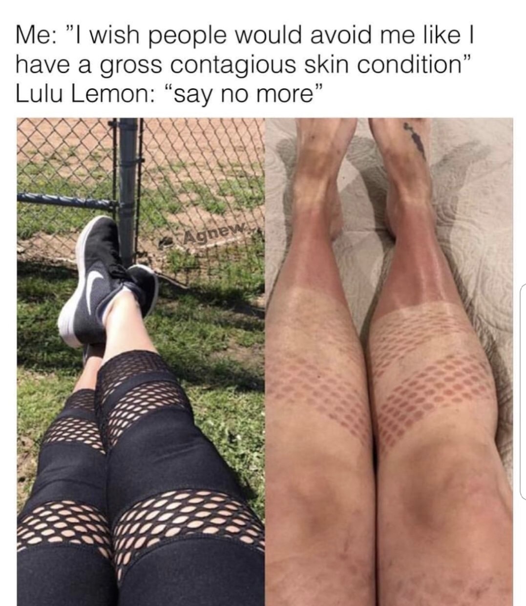 lulu lemon meme - Me "I wish people would avoid me | have a gross contagious skin condition Lulu Lemon say no more Agnew