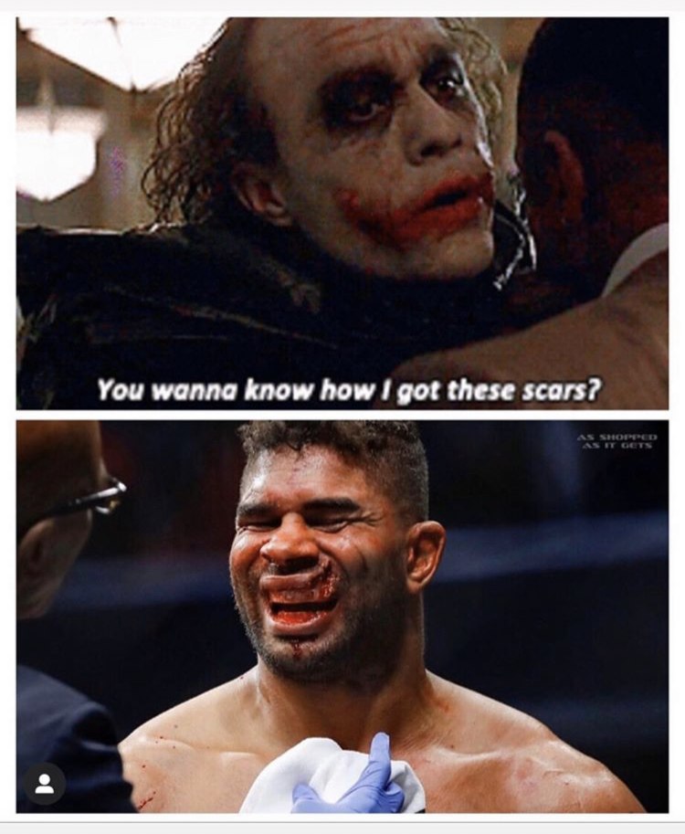 Alistair Overeem - You wanna know how I got these scars?