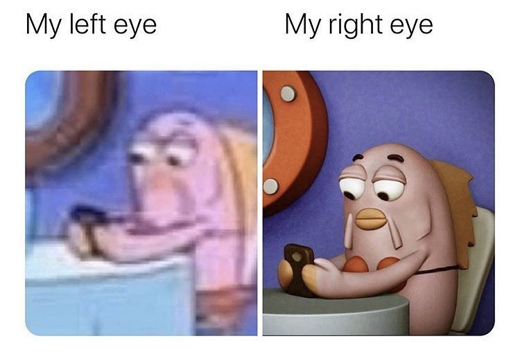 My left eye My right eye